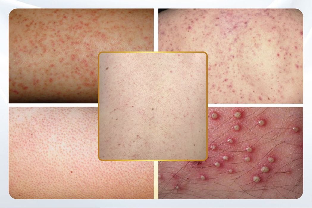 anhmota 20230619013101 u pbq