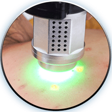 icon green laser 20230626011411 vvinl 1