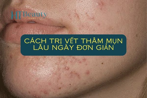 cách trị vết thâm mụn lâu ngày