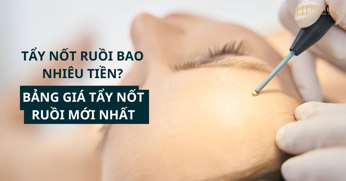 tẩy nốt ruồi bao nhiêu tiền? bảng giá tẩy nốt ruồi mới nhất