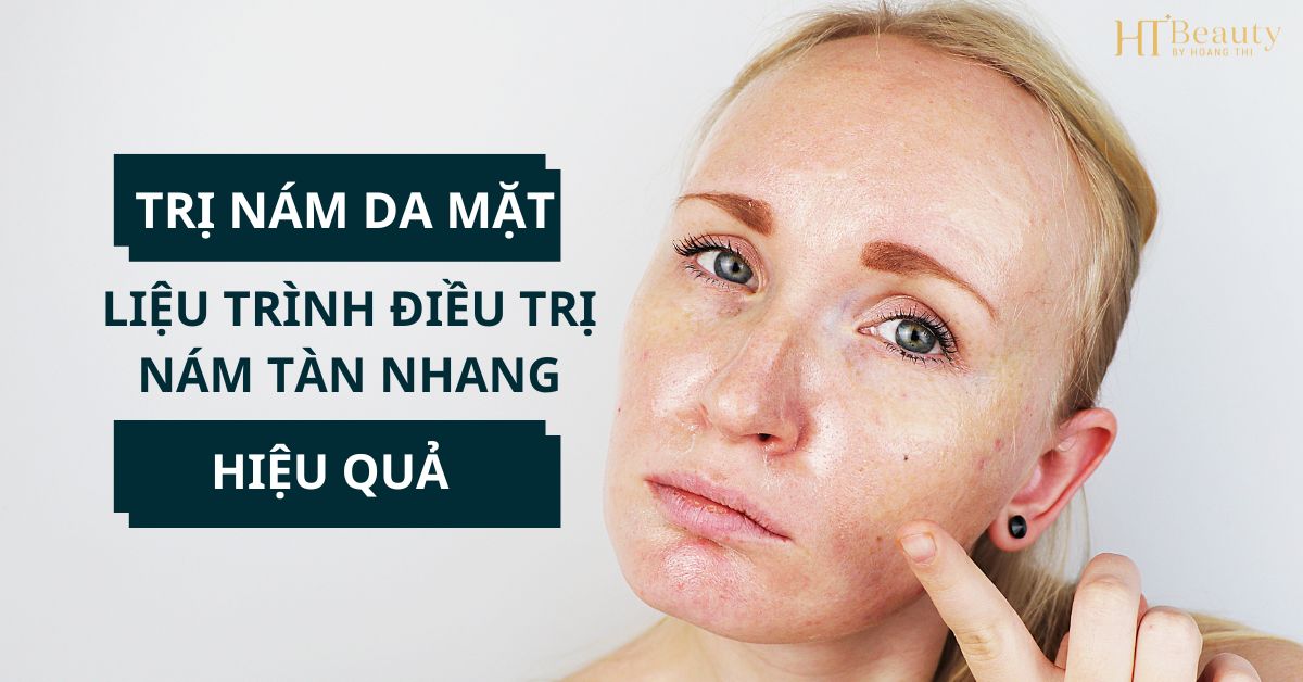 Trị nám da mặt liệu trình điều trị nám tàn nhang hiệu quả