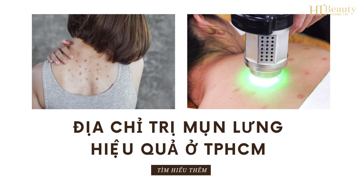 Địa Chỉ Trị Mụn Lưng Hiệu Quả Ở TPHCM