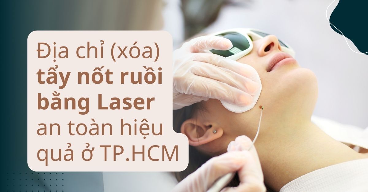 Địa chỉ tẩy (xóa) nốt ruồi bằng laser an toàn hiệu quả ở TP. HCM