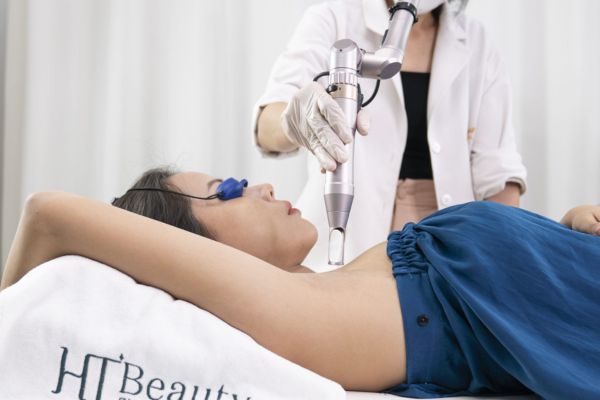 dieu tri tham body bang cong nghe extra metik