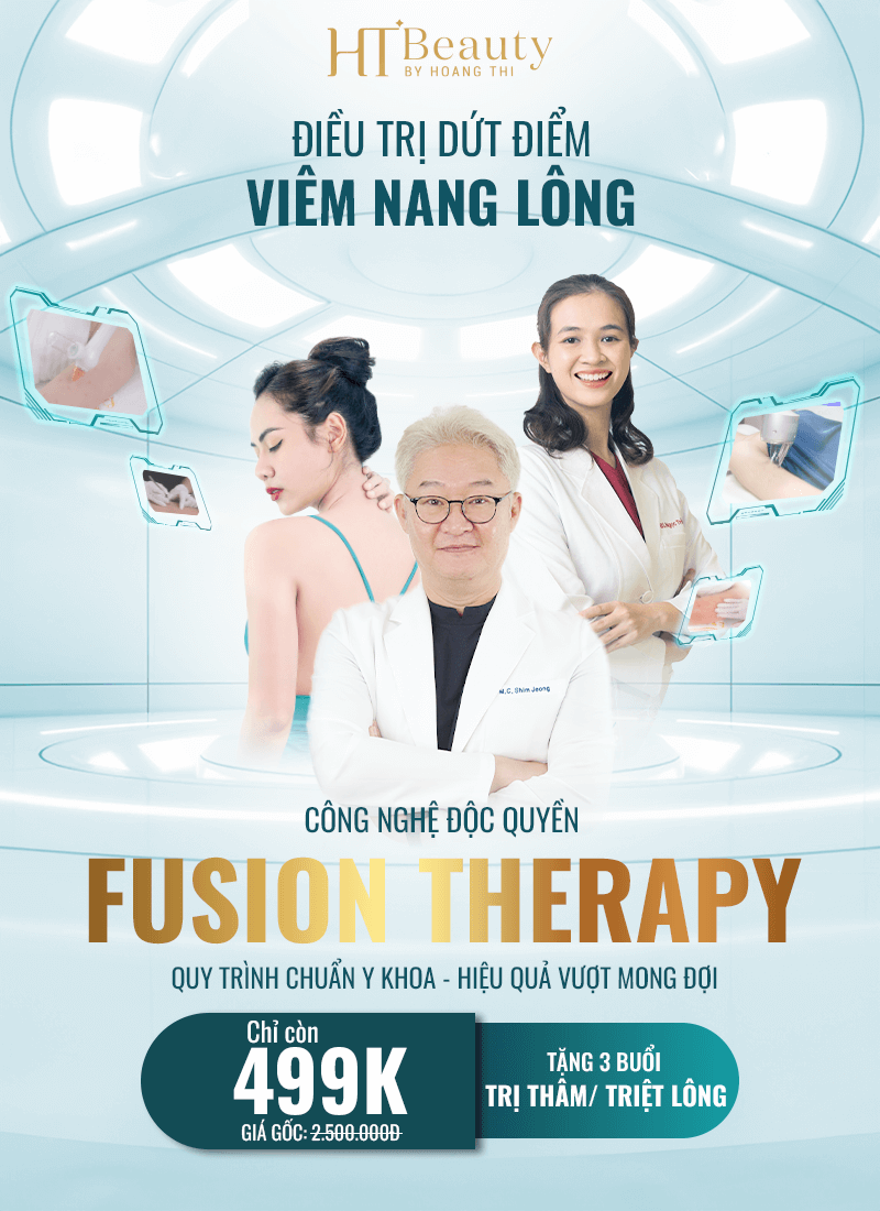 viem nang long banner mobi