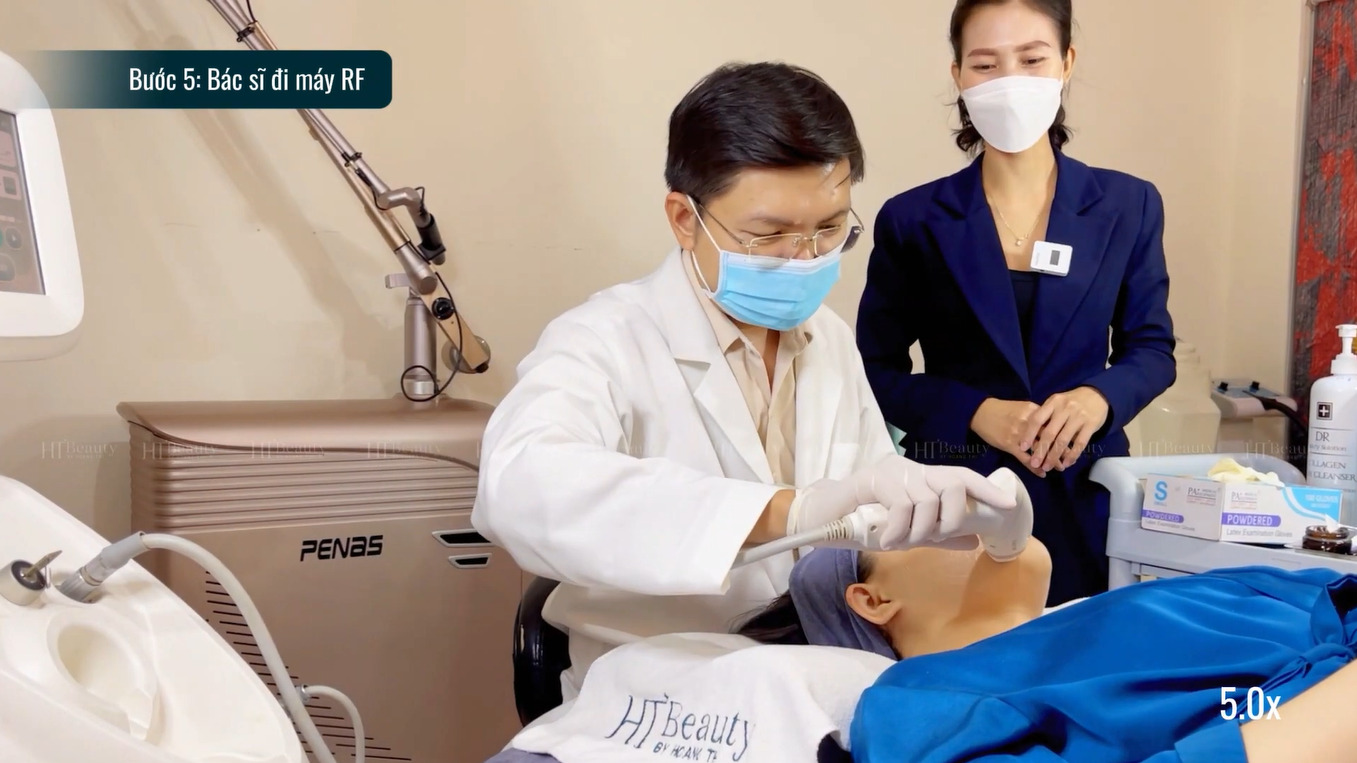 collagen cx5 quy trinh