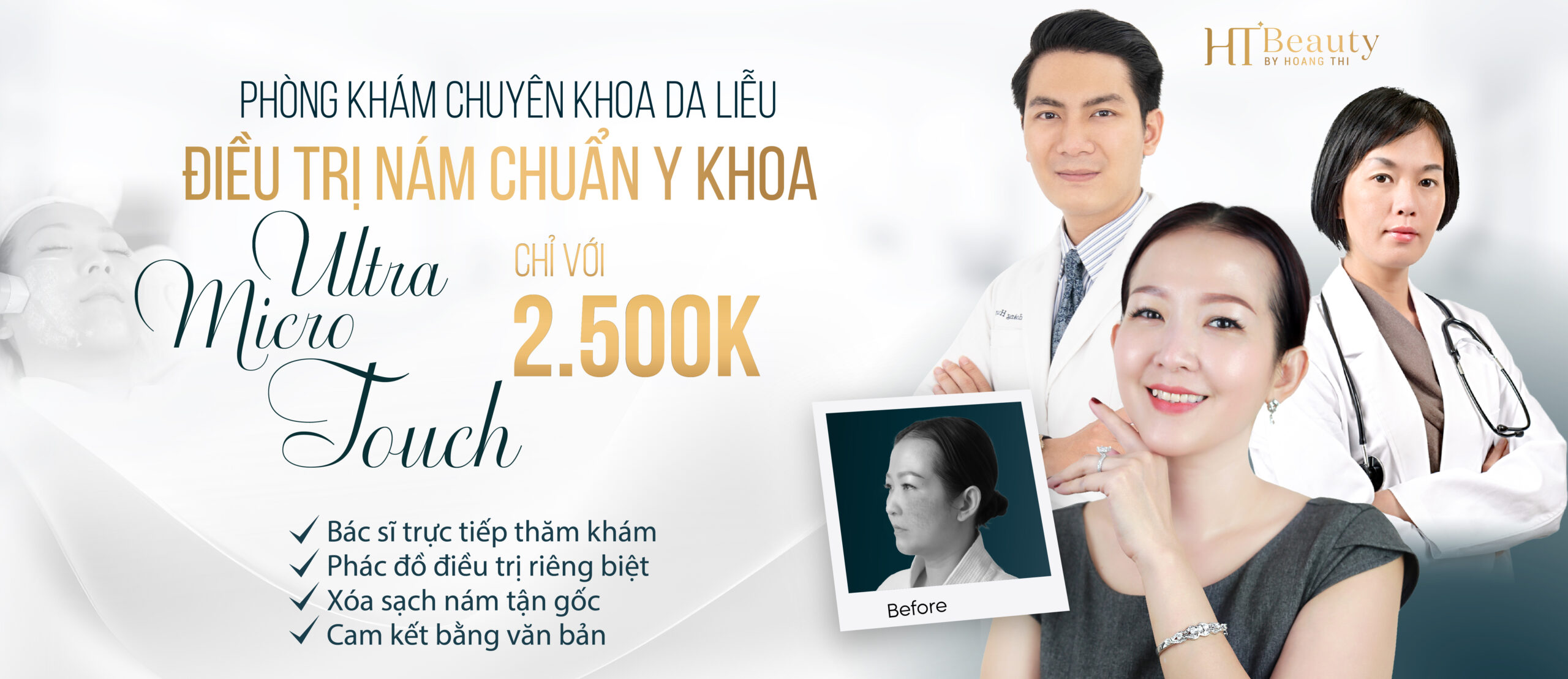 Cong nghe ultra Micro Touch Xoa sach nam 1500x650 2 01 scaled