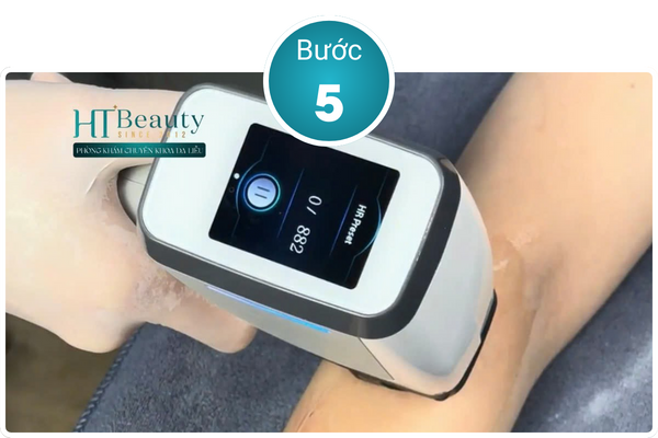 ban may diode laser roma