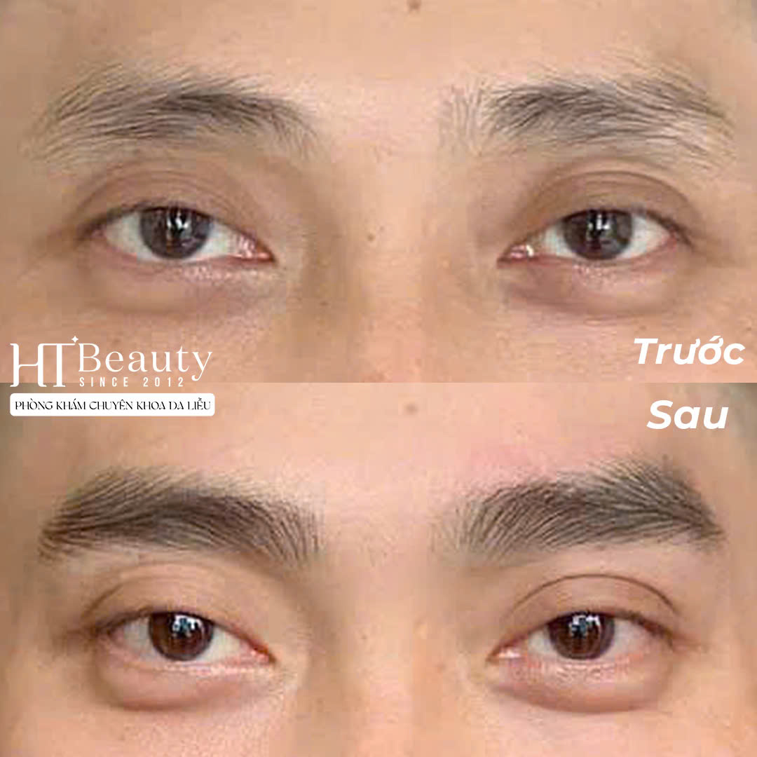 z6379814202816 fbeed7f7fc06b6ecf5fd8bd95ce26553