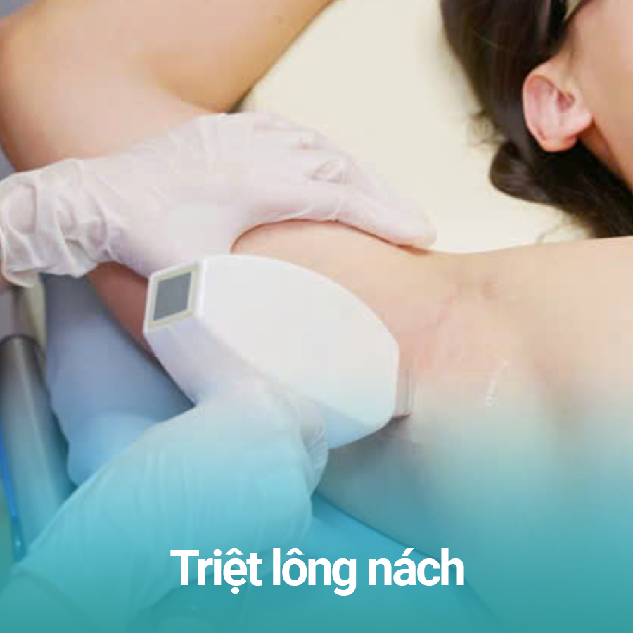 Triet nach nam dich vu