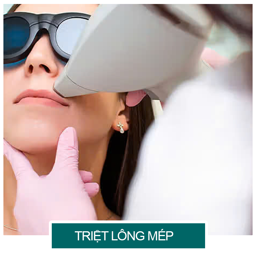 triet long mep NU