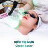 Trị Mụn Công Nghệ Green Laser