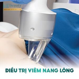 Điều Trị Viêm Nang Lông