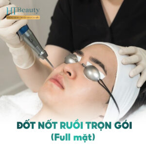 Đốt Nốt Ruồi Trọn Gói Full Mặt