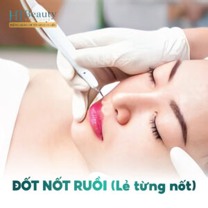 Đốt Nốt Ruồi