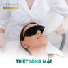 Triệt Lông Mặt – Da Sáng Mịn, Tự Tin Tỏa Sáng