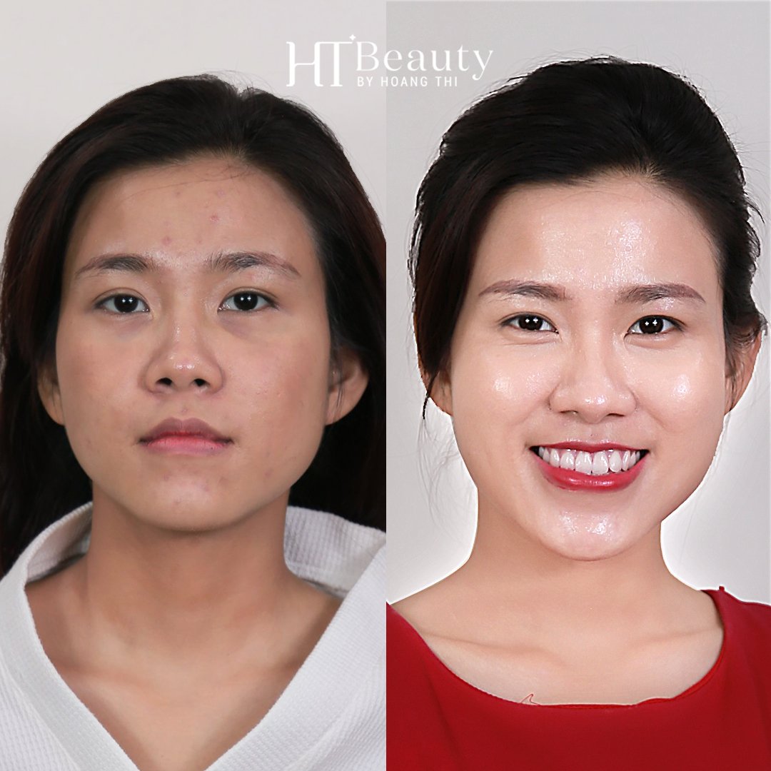 truoc sau trang sang da