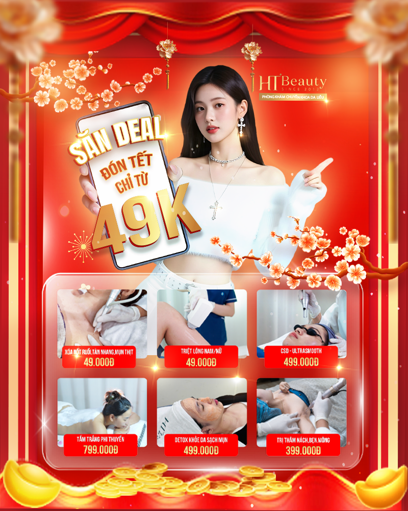 banner 49k uu dai MB