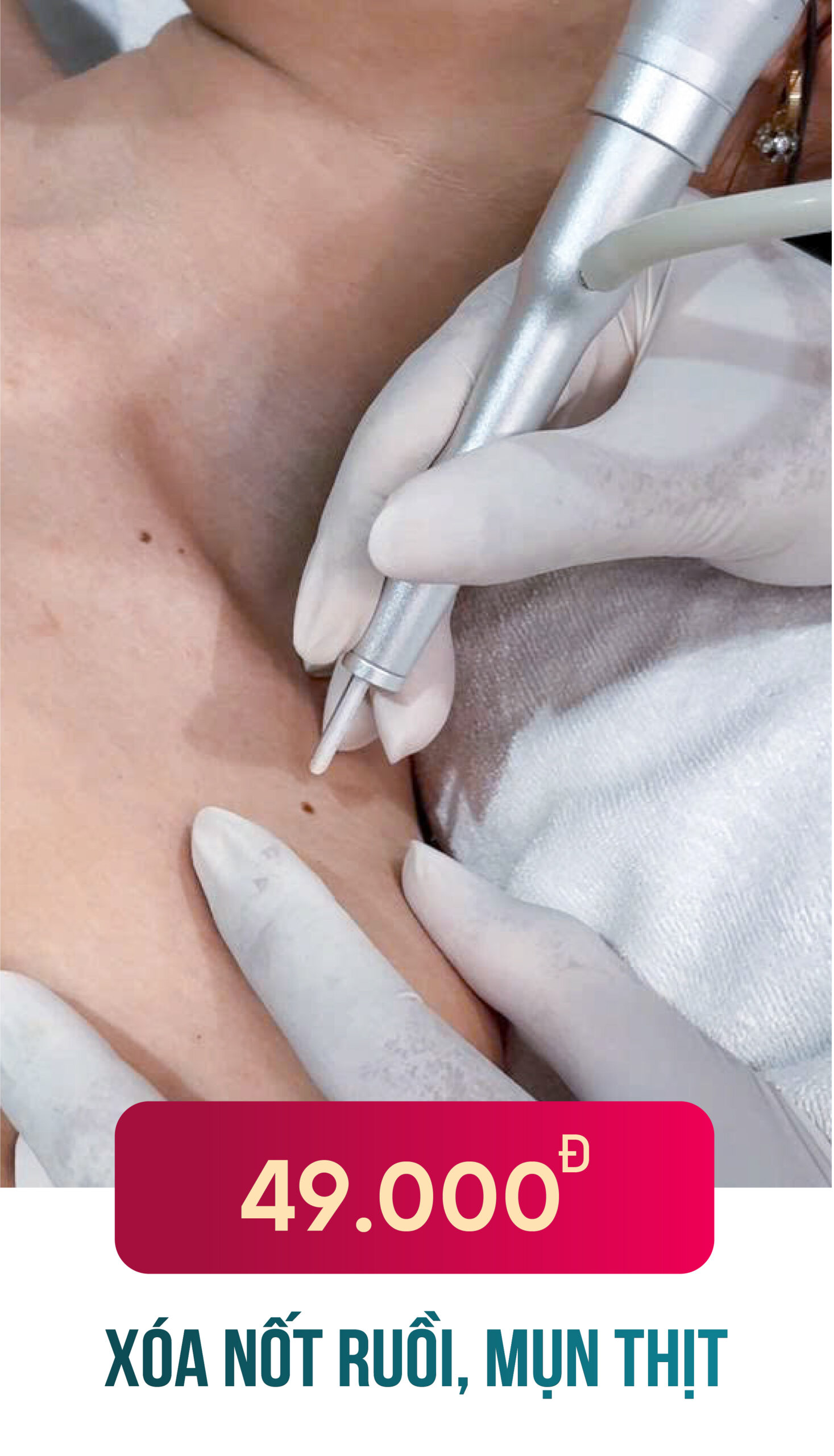 xoa not rui 1 scaled