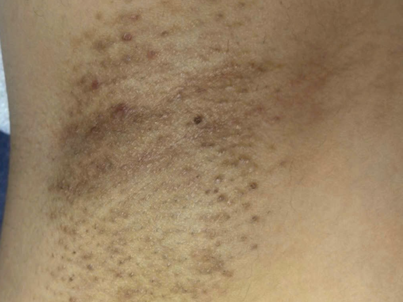 Before image