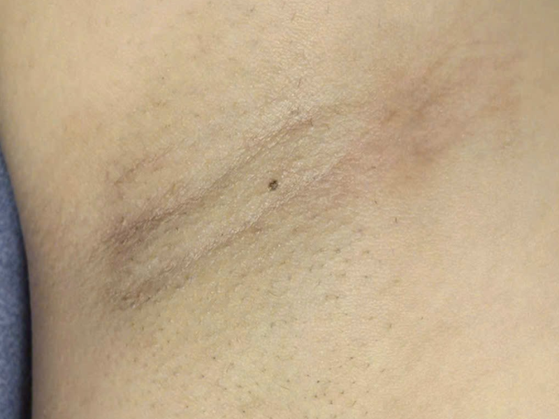 After image