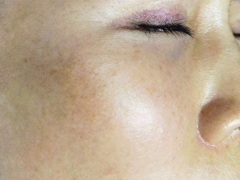 Before image