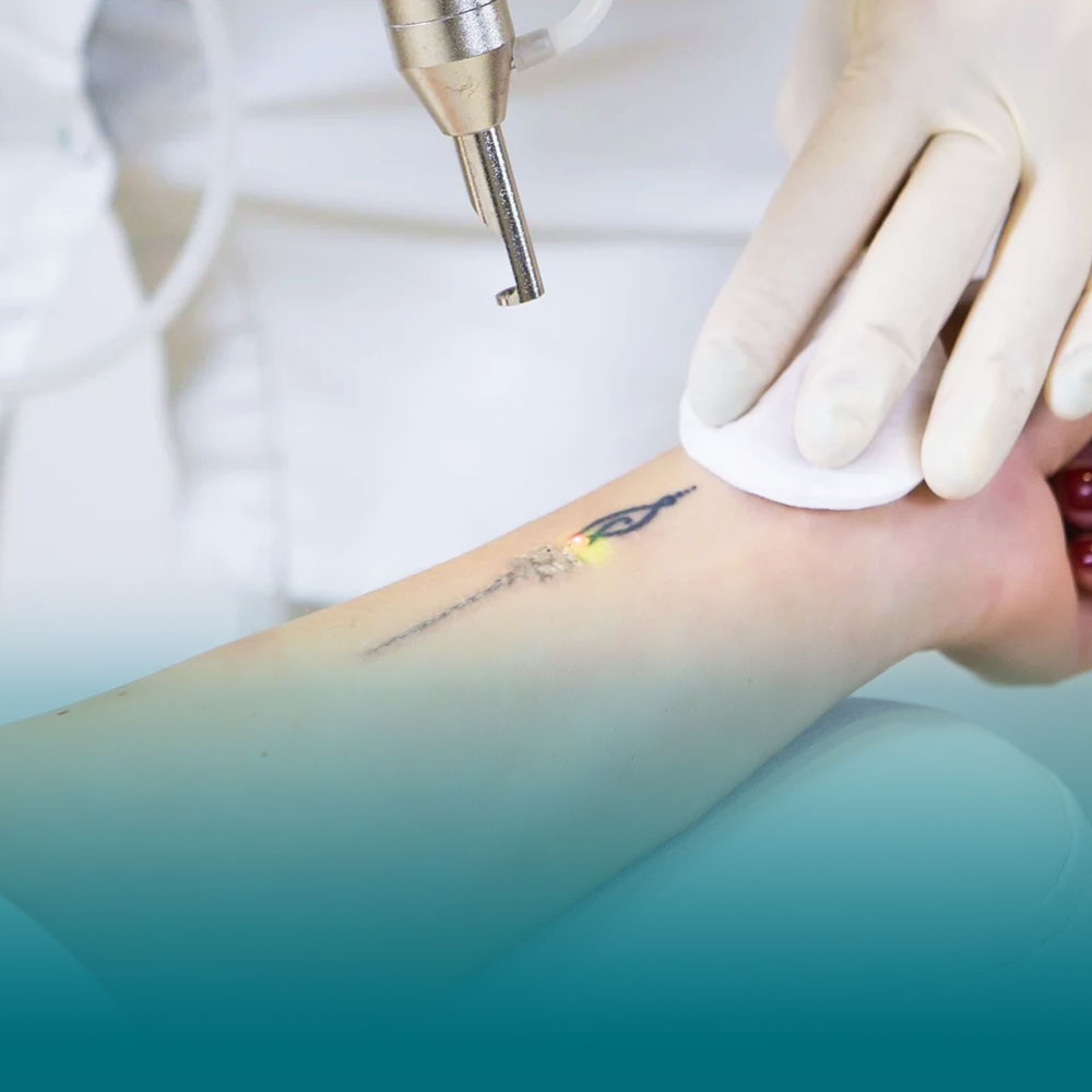 hinh dai dien menu dvArtboard 1 copy 17 1