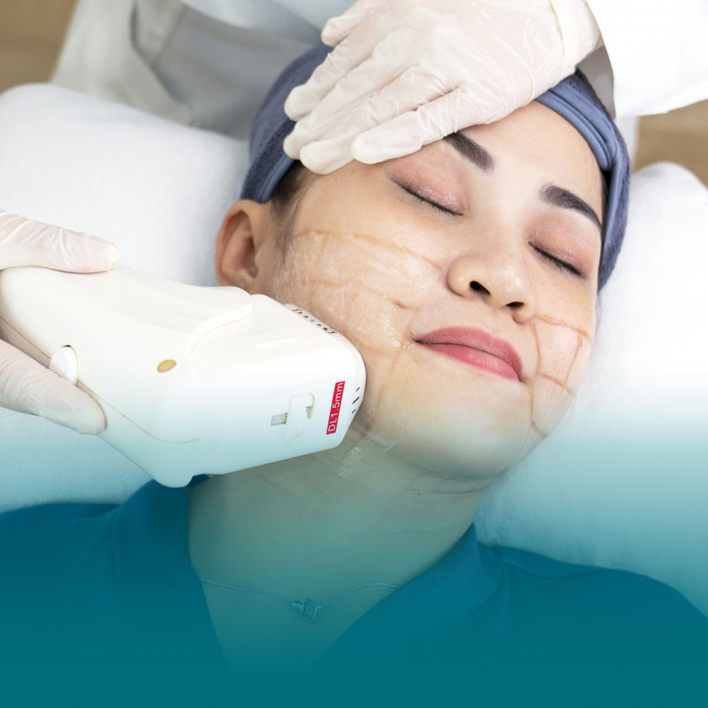 hinh dai dien menu dvArtboard 1 copy 7 1