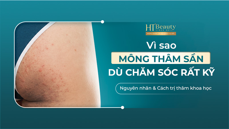thumbnail vi sao mong tham san du cham soc ky 1