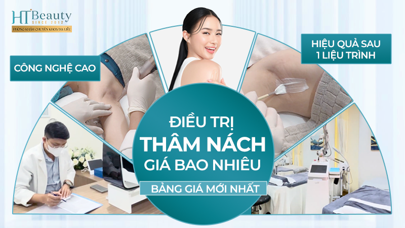 tri tham nach gia bao nhieu