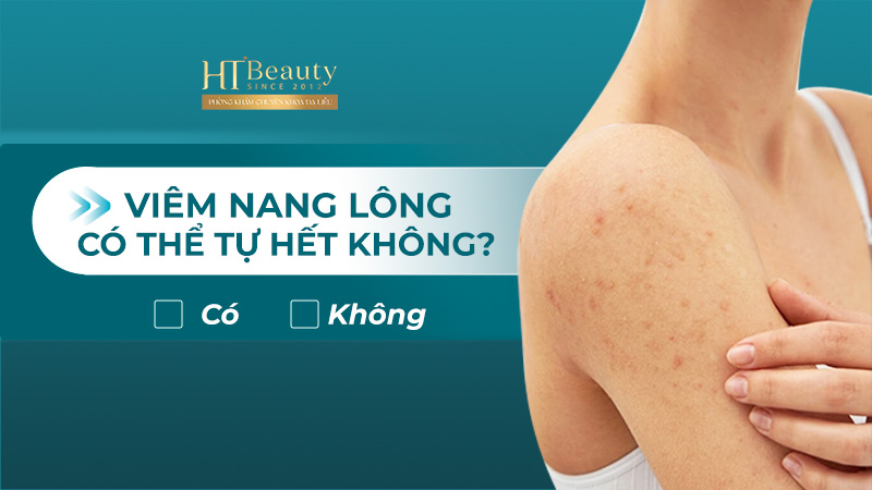 Viêm nang lông có thể tự hết không?