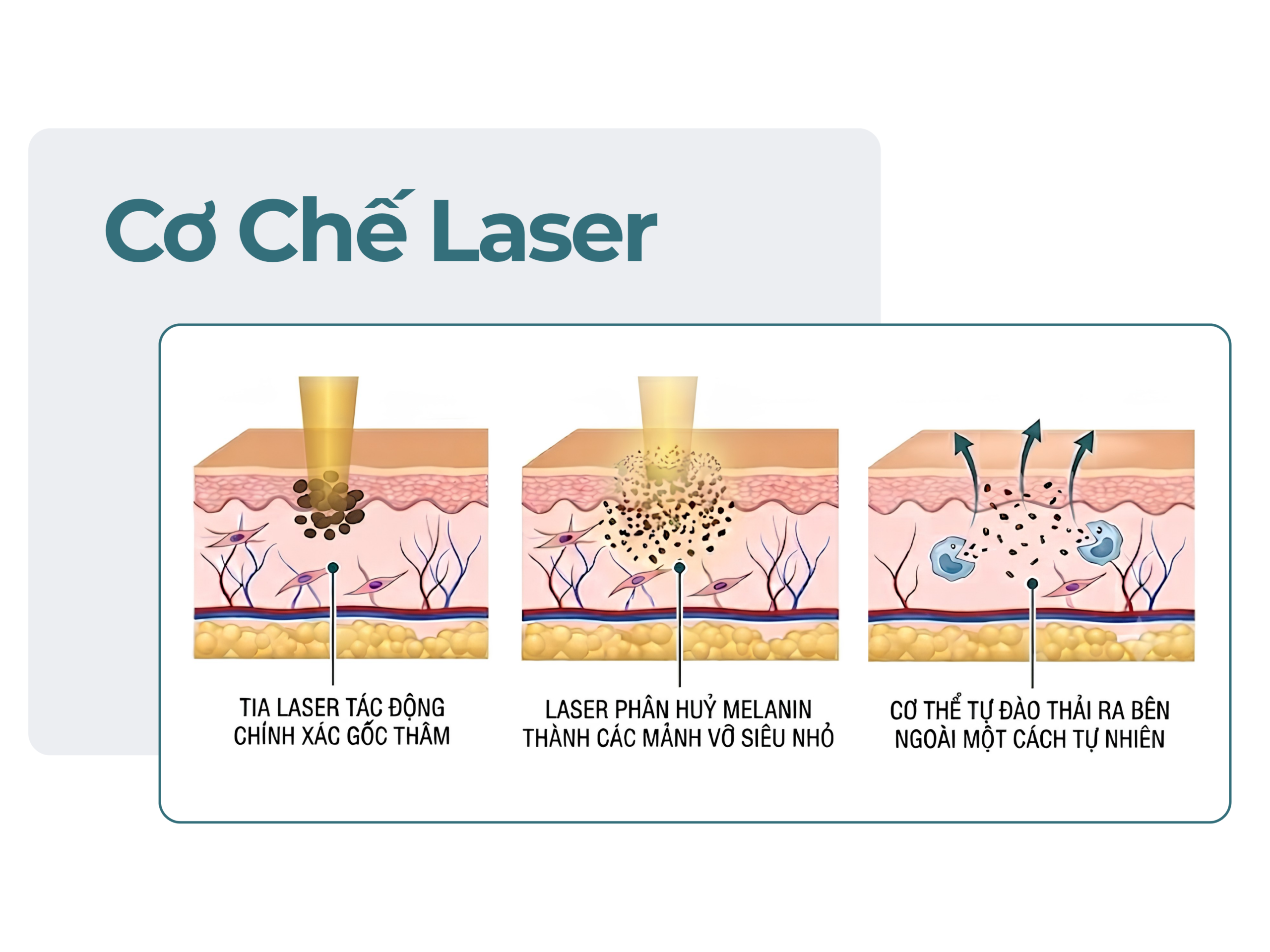 demo laser scaled
